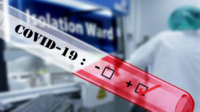 Covid 19 tests
