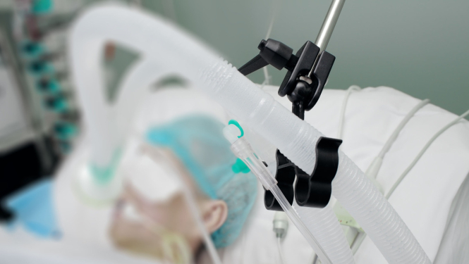 Slimnieks guļ slimnīcā ar plaušu ventilācijas aparātu